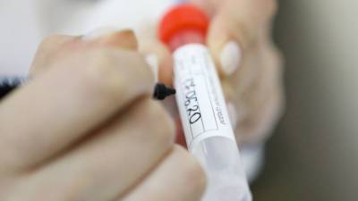 Российские медики выявили 24 715 новых случаев коронавируса за сутки