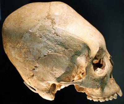 Венгерские археологи обнаружили на римском кладбище черепа необычной формы