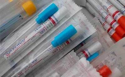 В России выявлено 23 586 новых случаев коронавируса