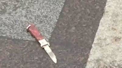 Школьница ранила 10-летнего мальчика канцелярским ножом в Смоленске