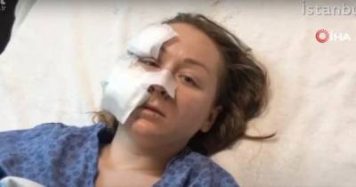 В Турции ревнивый муж порезал ножом лицо 28-летней украинке(видео)