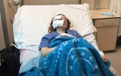 В Турции бывший муж порезал ножом лицо украинке