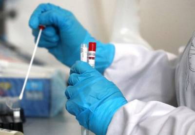В Украине выявили 3 939 новых случаев коронавируса