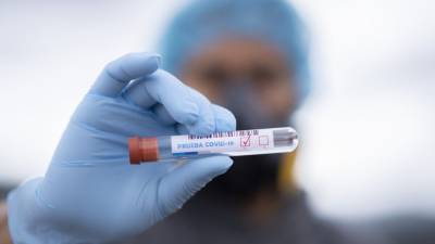 Российские медики выявили 21 734 новых случая коронавируса за сутки