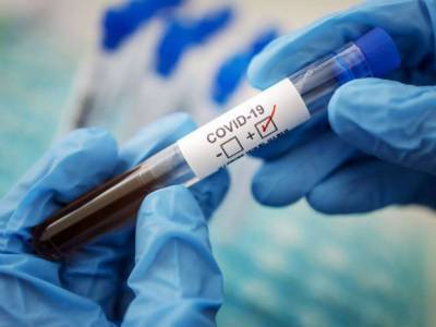 В Германии обнаружили новый тип коронавируса