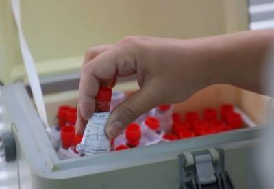 Украинские ученые разработали тест для оценки поствакцинального иммунитета к COVID-19