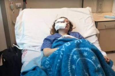 Ревнивый турок изрезал лицо жены-украинки: подробности. ФОТО, ВИДЕО
