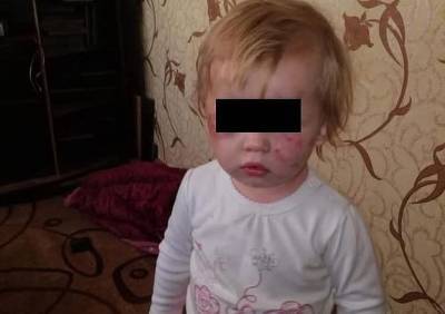 Детей, доставленных в Рязанскую ОДКБ, изъяли из семьи
