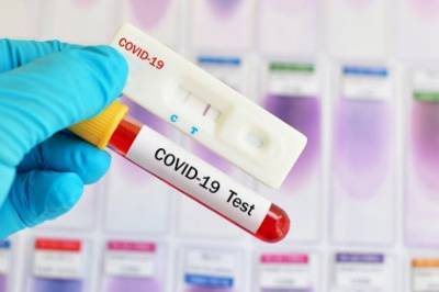 В Украине обнаружили 5 038 случаев COVID-19, еще более полусотни больных погибли