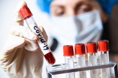 В РФ за сутки выявили 26 301 случай коронавирусной инфекции