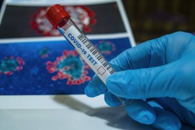 ВОЗ: за неделю число случаев коронавируса в мире возросло на 93 тысячи