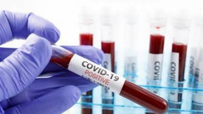 COVID-19: за сутки в Украине обнаружили 4383 новых больных
