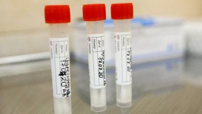 Оперштаб сообщил о 21 152 новых случаях коронавируса в России
