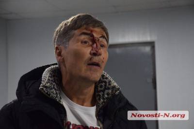 Разбитое в кровь лицо: В Николаеве экс-нардеп подрался с полицией