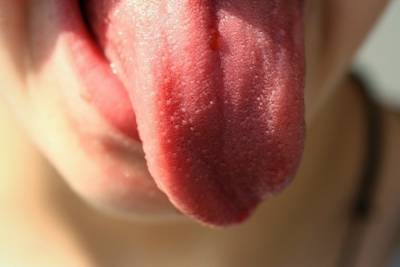 Ковидный язык: назван новый симптом заражения covid-19