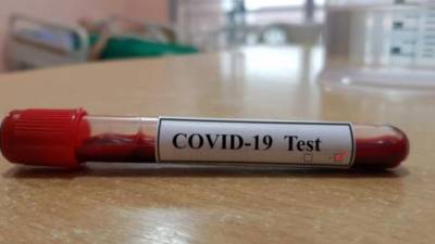 В Украине за сутки обнаружили более 5,5 тыс. новых больных коронавирусом