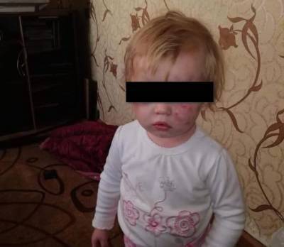 Рязанских мальчиков, попавших в ОДКБ с множественными гематомами, отдадут в дом ребенка