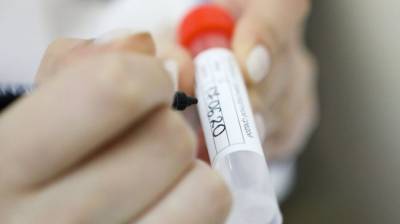Российские медики выявили 21 513 новых случаев коронавируса за сутки