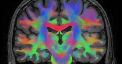 Ученые рассказали, отличается ли мозг атеистов от мозга верующих