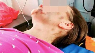 Под Самарой женщину оштрафовали за громкие крики во время избиения мужем