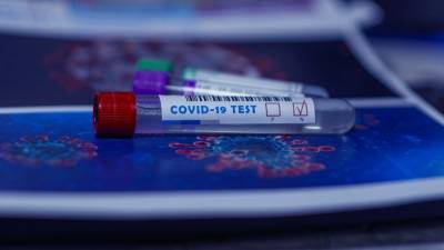 В России выявили 20 921 случай коронавируса за последние сутки