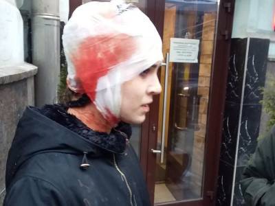 Активистке "ФемФракции" в Москве разбили голову