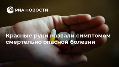 Красные руки назвали симптомом смертельно опасной болезни