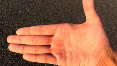 Медики обнаружили связь между покраснением рук и болезнью печени