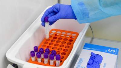 Мутации коронавируса будут выявлять в РФ с помощью нового ПЦР-теста