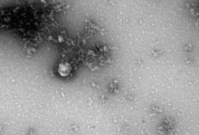 Учёные Роспотребнадзора впервые сфотографировали британский штамм коронавируса