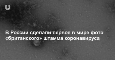 В России сделали первое в мире фото «британского» штамма коронавируса