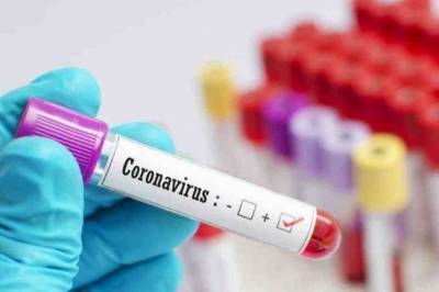 В Украине обнаружили минимальное за четыре месяца количество больных COVID-19 - 2 516 новых случаев за сутки