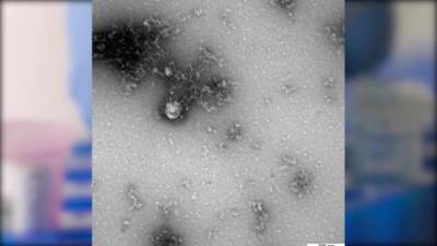 Роспотребнадзор получил первое изображение британского штамма коронавируса