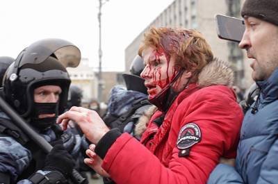В Москве после акции в поддержку Навального в больницы обратились более 40 человек
