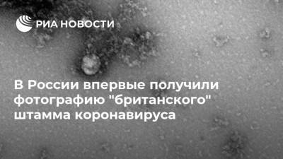 В России впервые получили фотографию "британского" штамма коронавируса