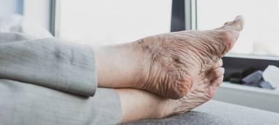 В Карелии одиноким старикам бесплатно подстригли ногти на ногах