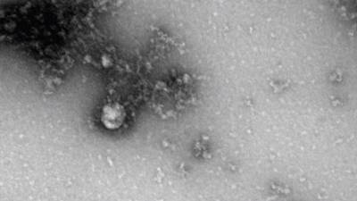 Российские учёные сделали первую в мире фотографию британского штамма коронавируса