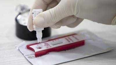 Мурашко назвал сроки сохранения иммунитета у переболевших коронавирусом