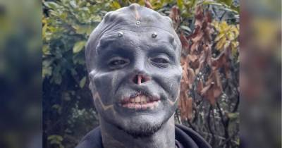 Превращение в «черного инопланетянина»: удаливший себе нос француз отрезал верхнюю губу
