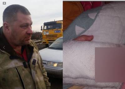 Малышку с отрубленным пальцем не пропустили через мост Малиновского, но помогли добрые люди