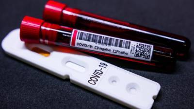 Пандемия коронавируса: В Украине за сутки 3 776 новых случаев COVID-19