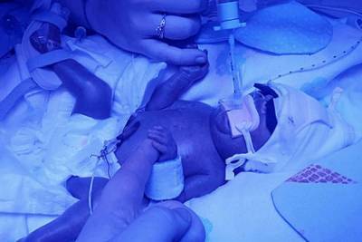 Младенец переболел сепсисом, COVID-19 и кишечной палочкой и выжил вопреки всему