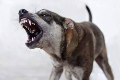 10-летнего мальчика покусали собаки на улице Недорезова в Чите