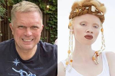 В сети обсуждают расистскую статью Андрея Колесникова в "Коммерсанте" о южноафриканской модели с альбинизмом