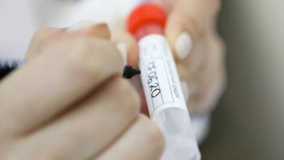В США рассказали о самой "достоверной" версии появления коронавируса