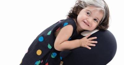 Двухлетняя бразильская девочка стала звездой Сети из-за редкого генетического заболевания (фото)