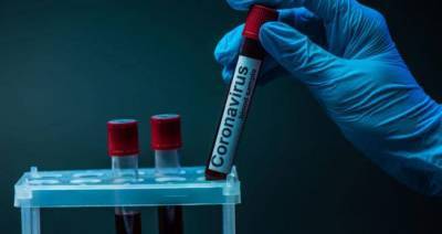 В Луганской области лабораторно подтверждено 25 новых случаев COVID-19