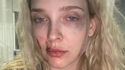 Полиция разбирается в обстоятельствах избиения актрисы в столичном клубе