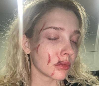 Певица Степановская сообщила об избиении в московском клубе