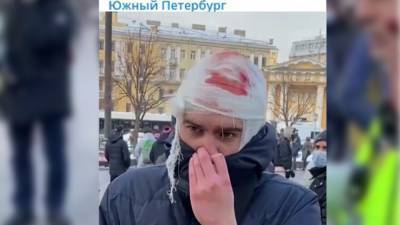 Петербурженка вычислила на незаконной акции провокатора с "разбитой головой"